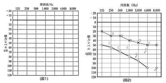 画像：正しい規格のオージオグラムとその記載例